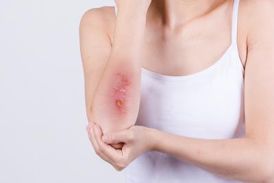 微酸性次氯酸水