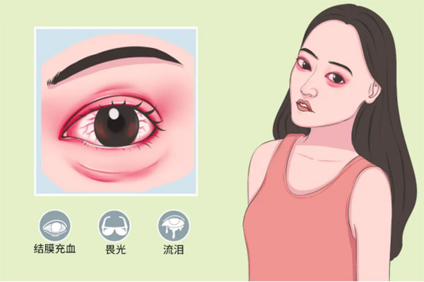 次氯酸治療細菌性和病毒性結膜炎