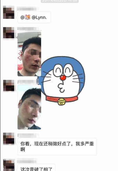 特應(yīng)性皮炎苦不堪言 特應(yīng)性皮炎苦不堪言