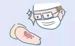 盛懷次氯酸水可治療慢性傷口